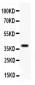 Anti-GAD67 Picoband Antibody